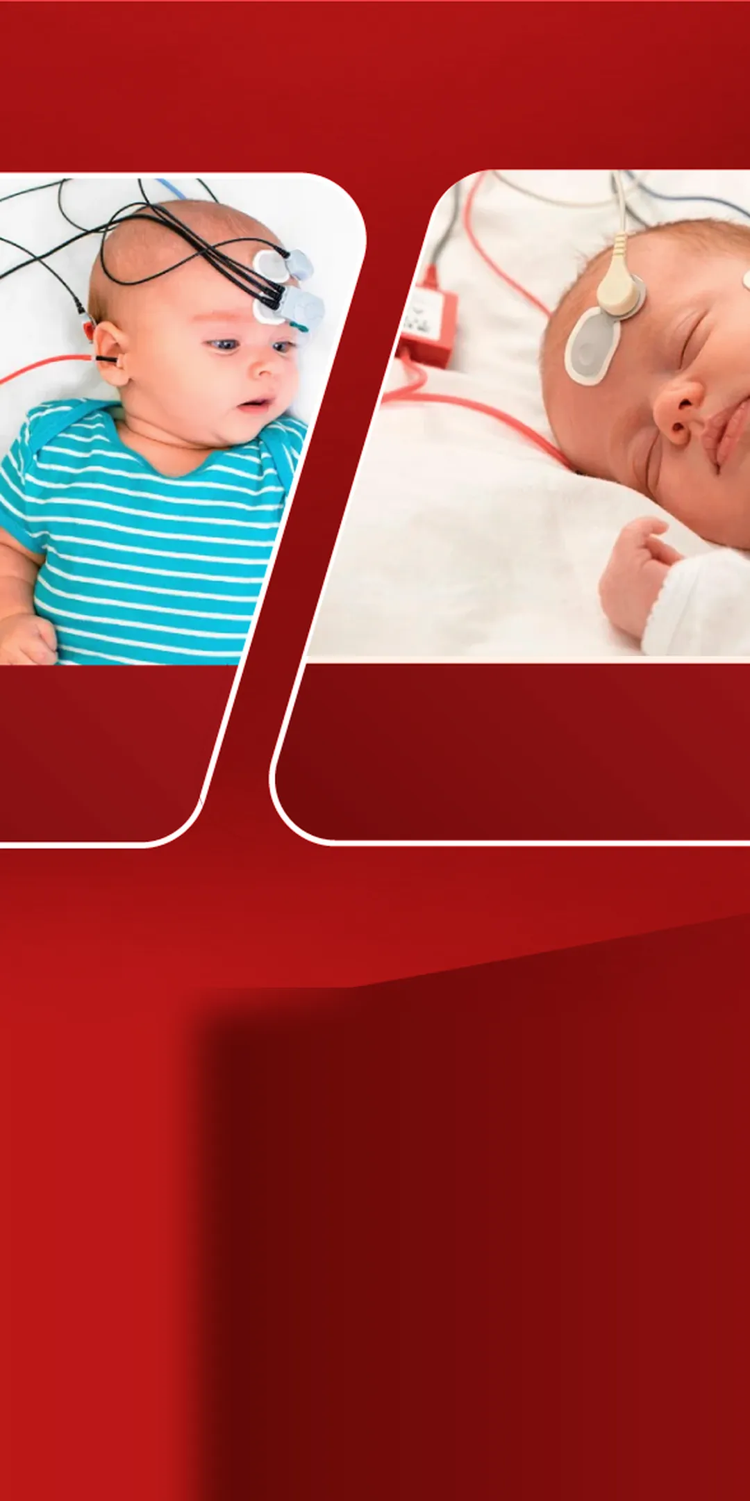 নবজাতকের শ্রবণ পরীক্ষা চলছে — OAE, ABR ও ASSR